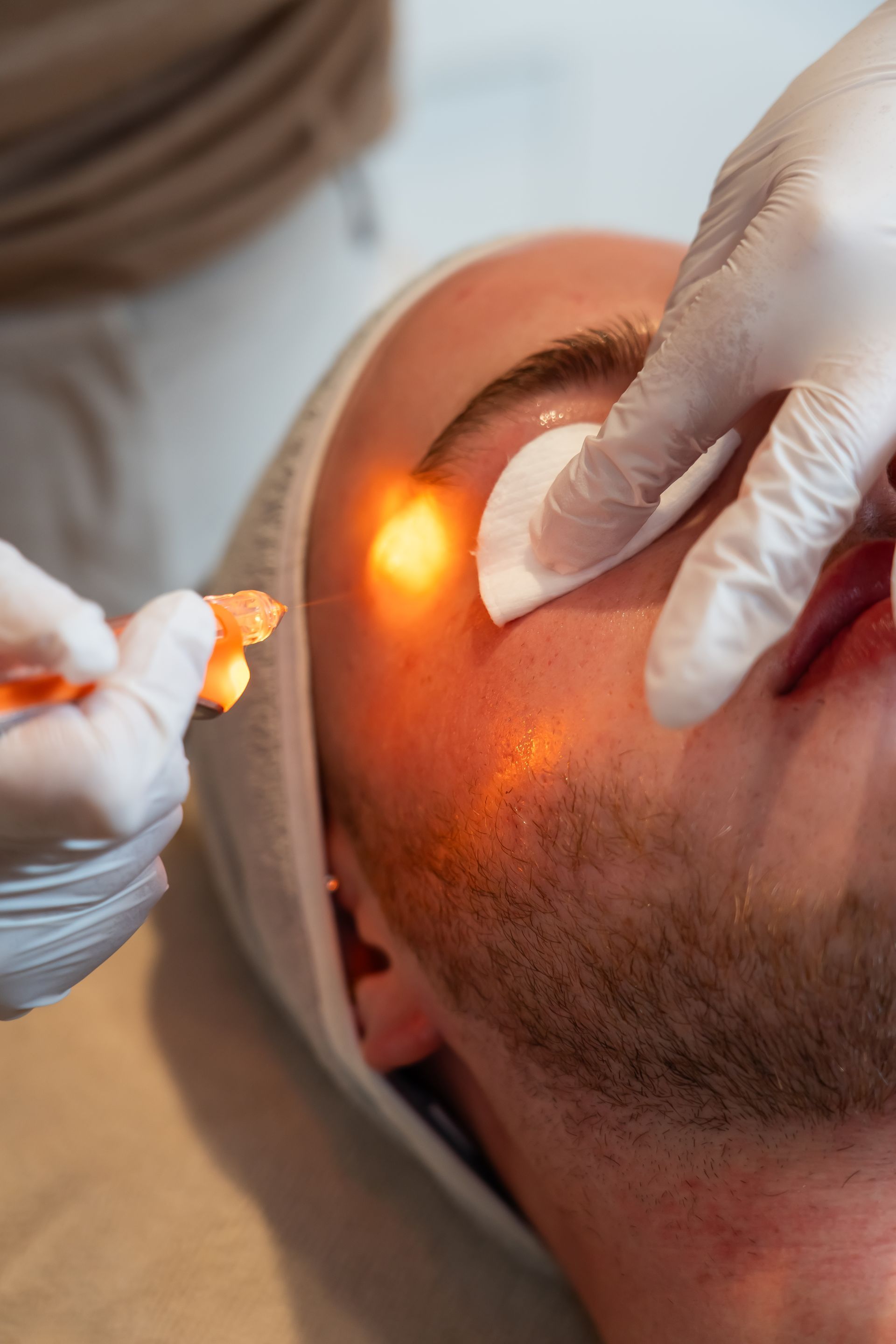 Complete Eye Renewal treatment for dark circles and under-eye concerns