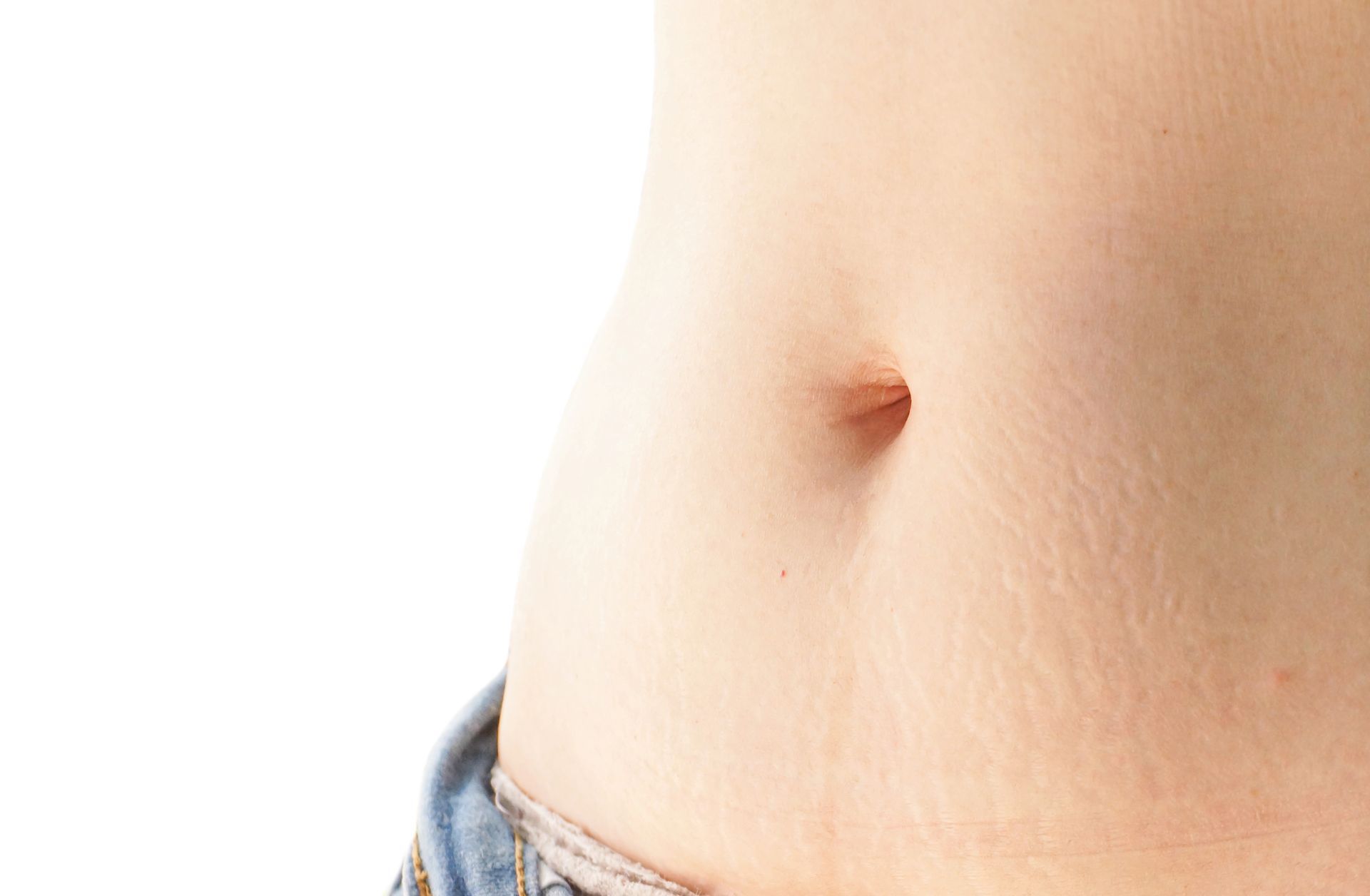 Post Pregnancy Skin Treatment at Gustil Aesthetics Amsterdam