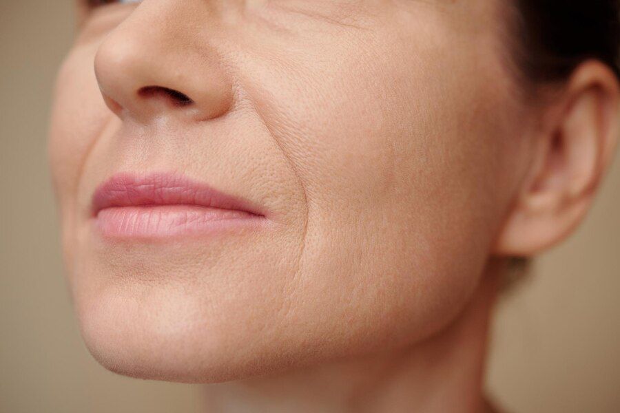 Soft visual for fine lines and ageing
