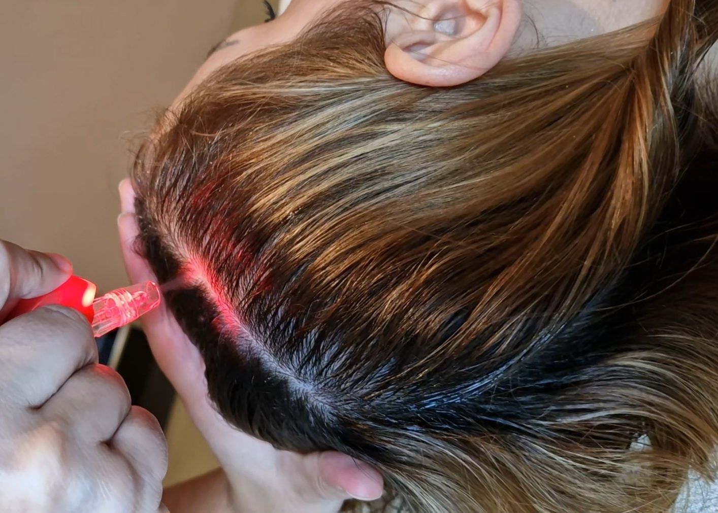 Hair Growth & Scalp Treatments