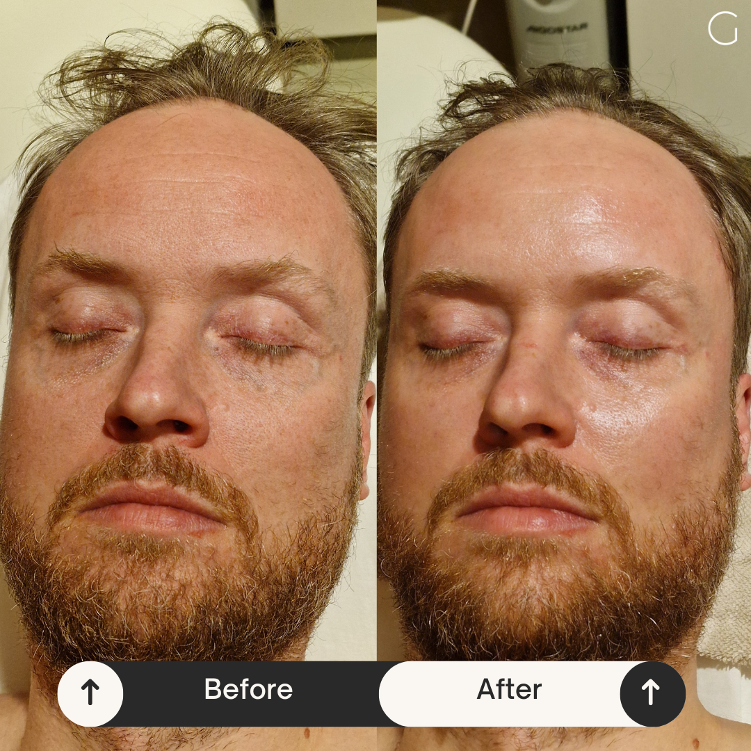 Premium clinic treatment