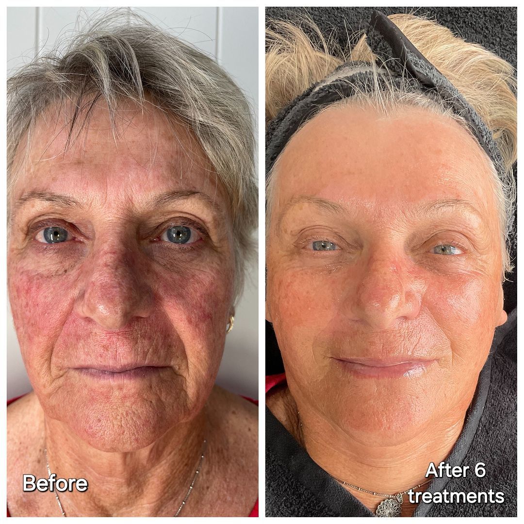 Before and after 2