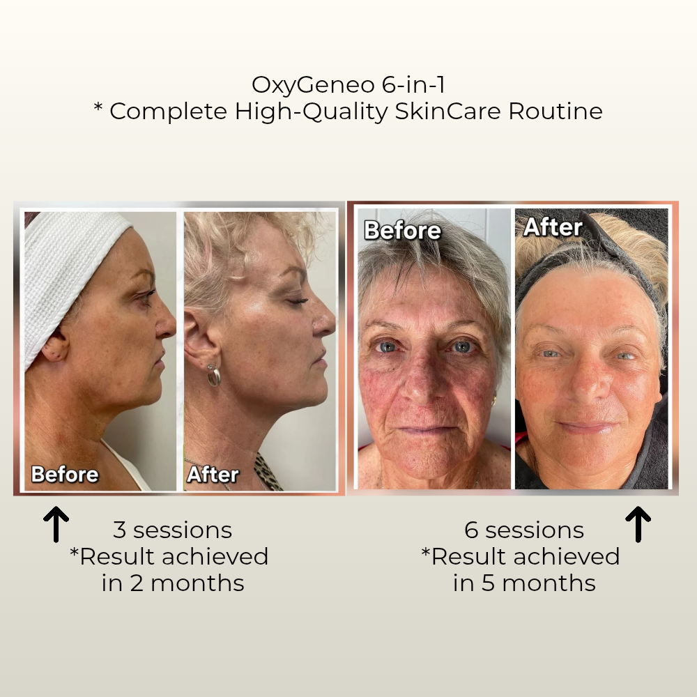 Skin Longevity before and after square result Gustil Aesthetics Amsterdam