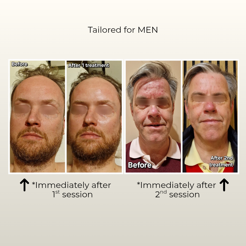 Skin Longevity before and after square result Gustil Aesthetics Amsterdam