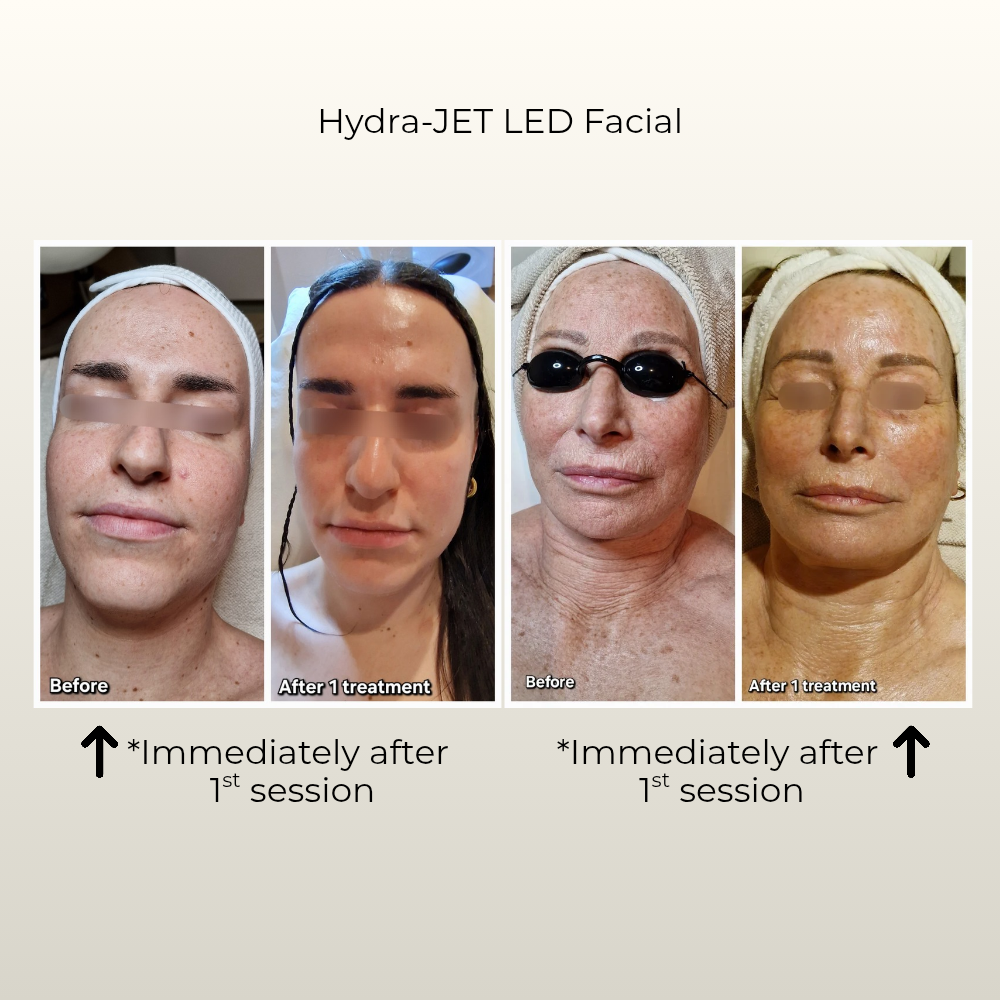 Skin Longevity before and after square result Gustil Aesthetics Amsterdam