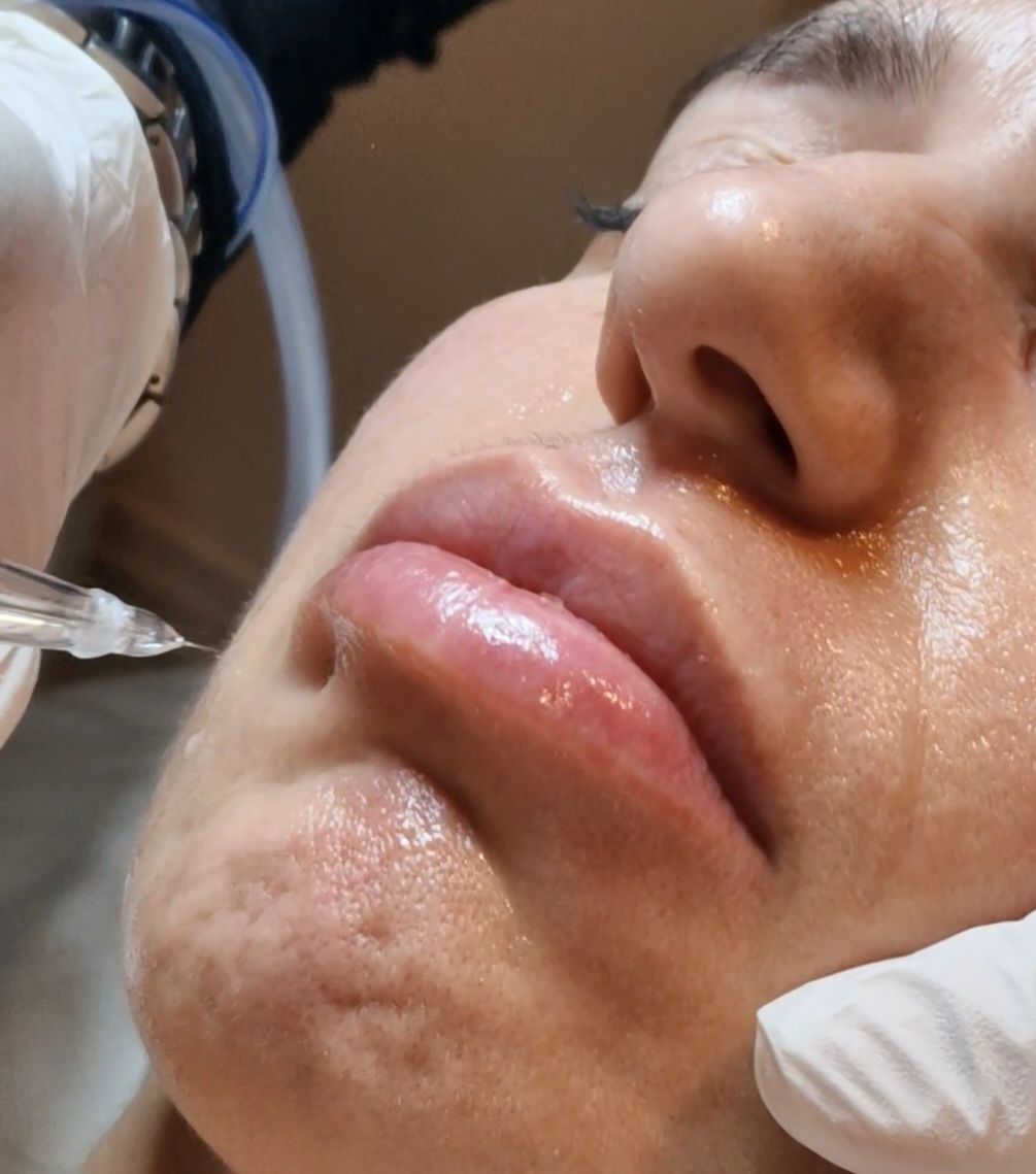 Velvet Skin Facial