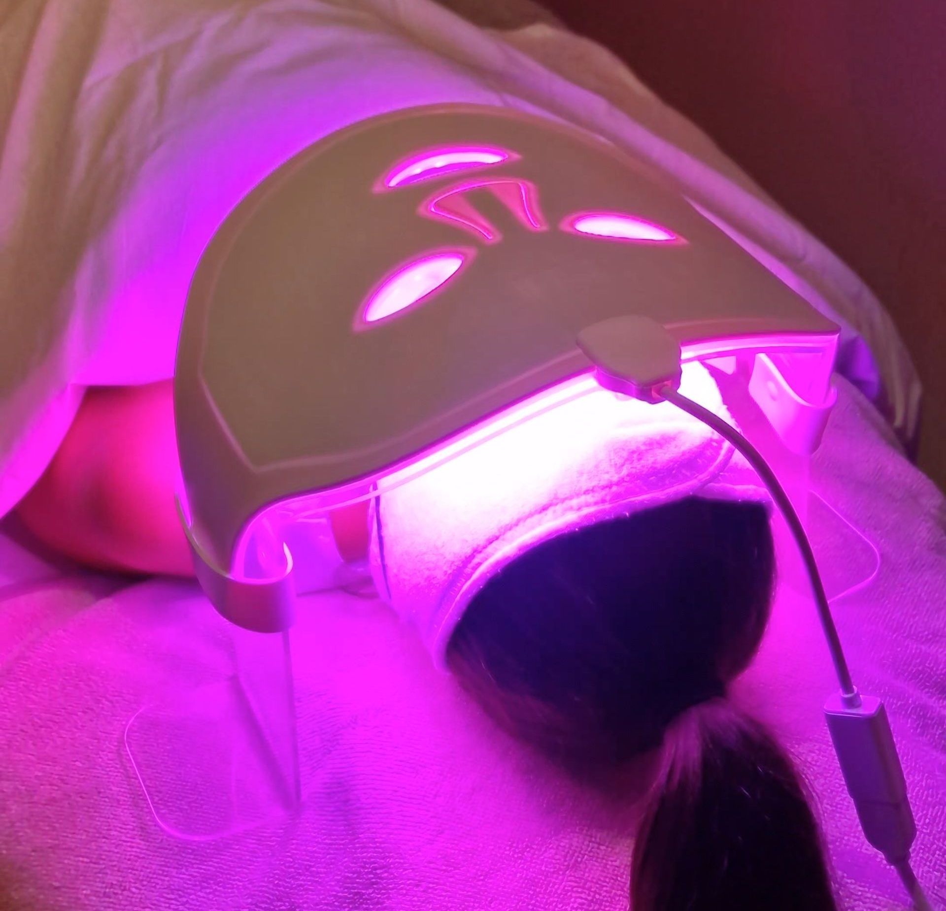 PhotoBiodynamic Therapy  Acne Treatment with Violet light