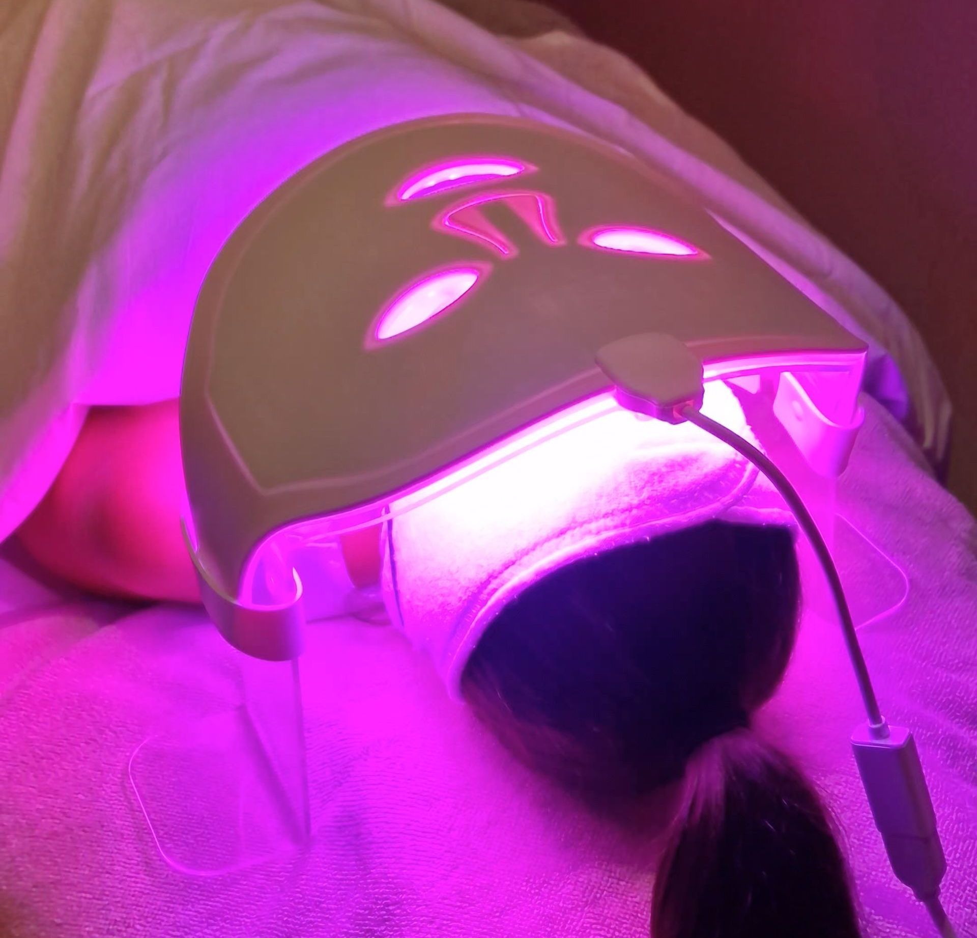 Velvet Skin with Violet HDD Light for acne and inflammation