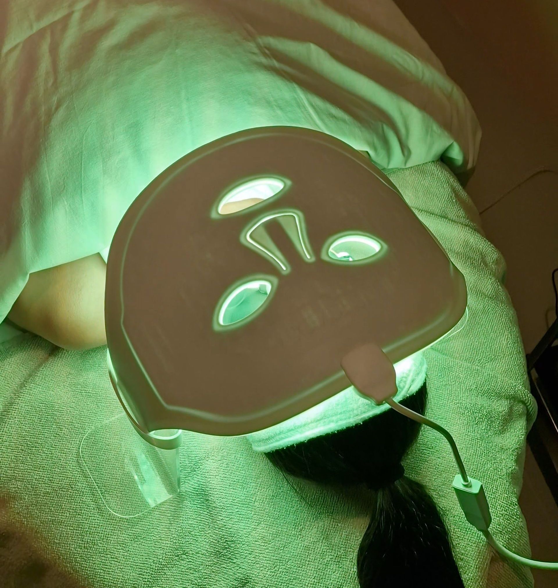 PhotoBioDynamic Light therapy for hyperpigmentation with green light