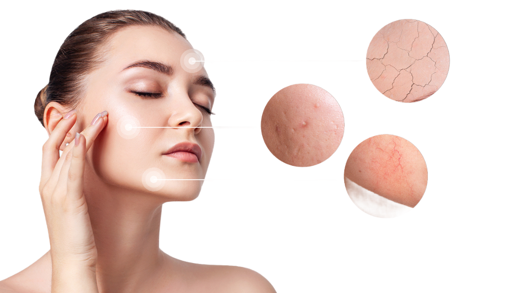 Buy Products for your Skin Concerns
