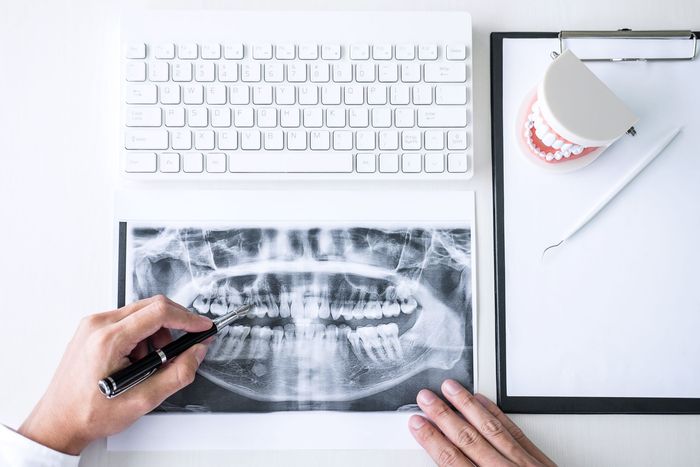 Un dentista esamina una radiografia panoramica dentale su una scrivania, accanto a un computer portatile, una tazza di caffè e una penna.