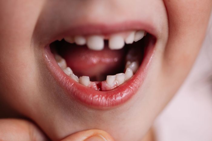 Denti da latte durante la visita del dentista per bambini a Firenze