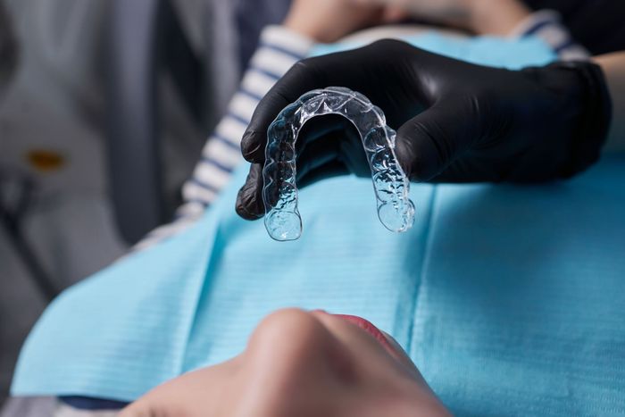 Un dentista tiene un apparecchio trasparente sui denti di un paziente.