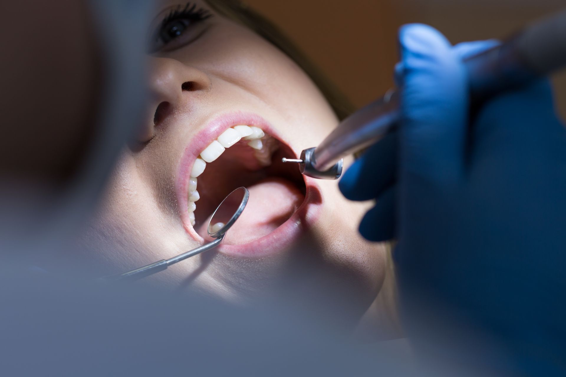 Primo piano della bocca aperta di un paziente mentre un dentista utilizza degli strumenti durante una visita odontoiatrica.