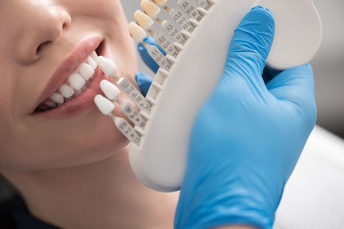 Una donna si fa sbiancare i denti dal dentista.