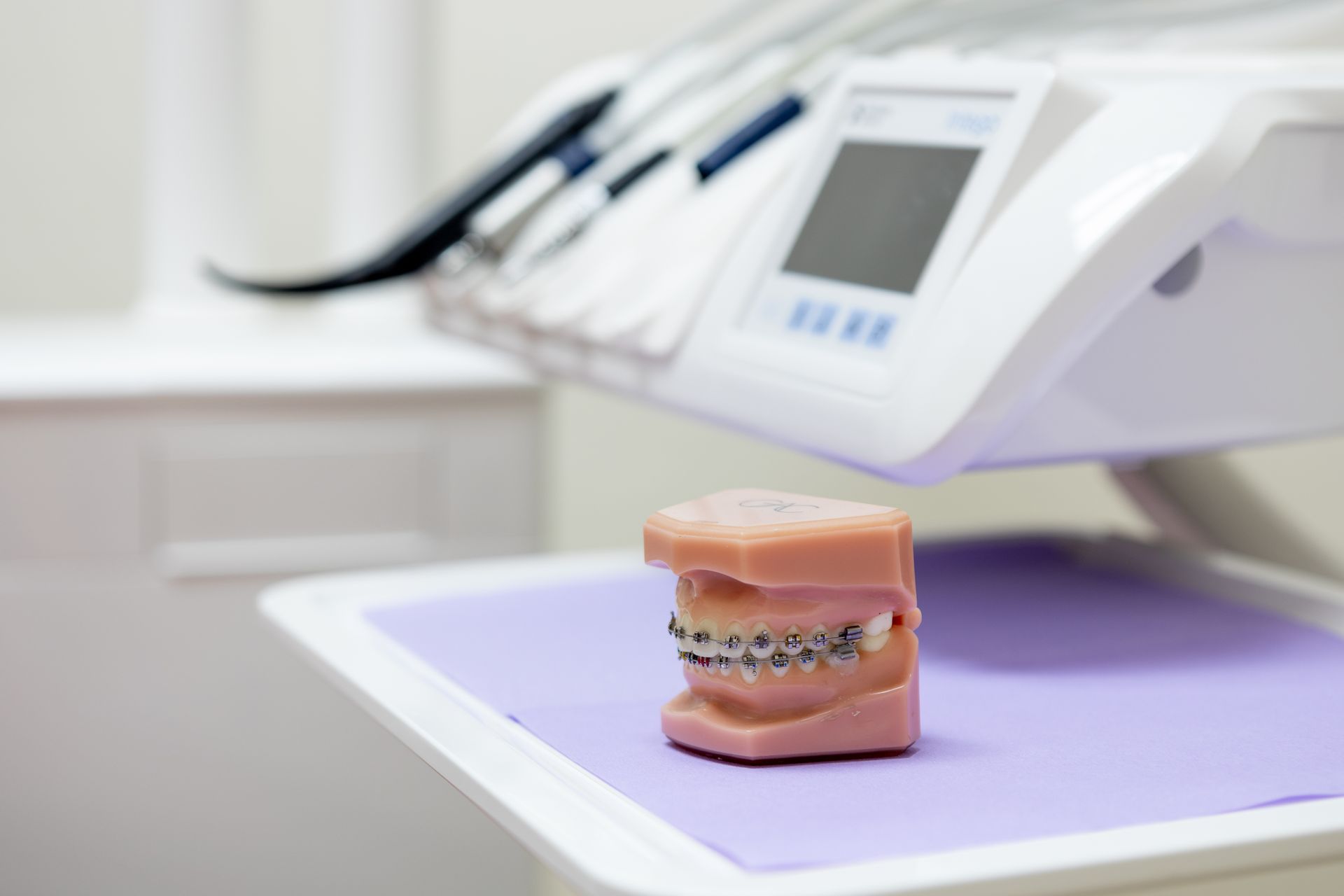 Modello dentale con apparecchio ortodontico su un vassoio viola accanto a uno scanner dentale in una clinica.