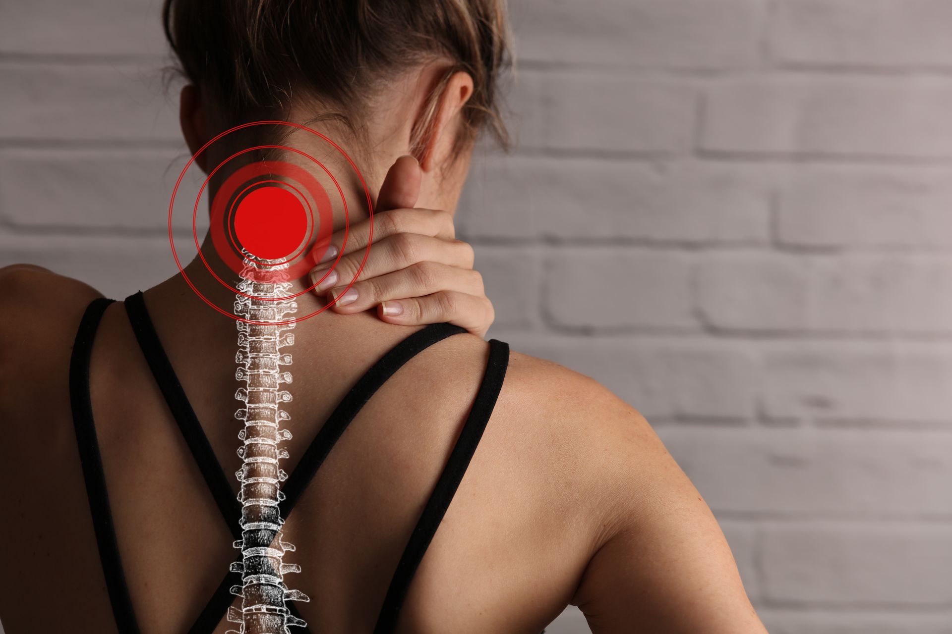A woman holding her neck in pain with a spine overlay highlighting the upper cervical injury area A woman holding her neck in pain with a spine overlay highlighting the upper cervical injury area