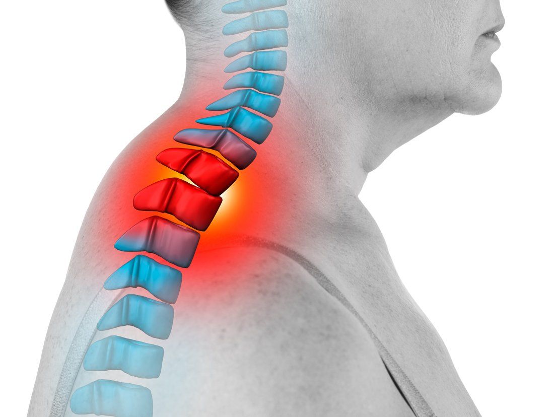 Cervical Spine Isolated - Alexandria, Louisiana - Alexandria Spine & Rehab Center