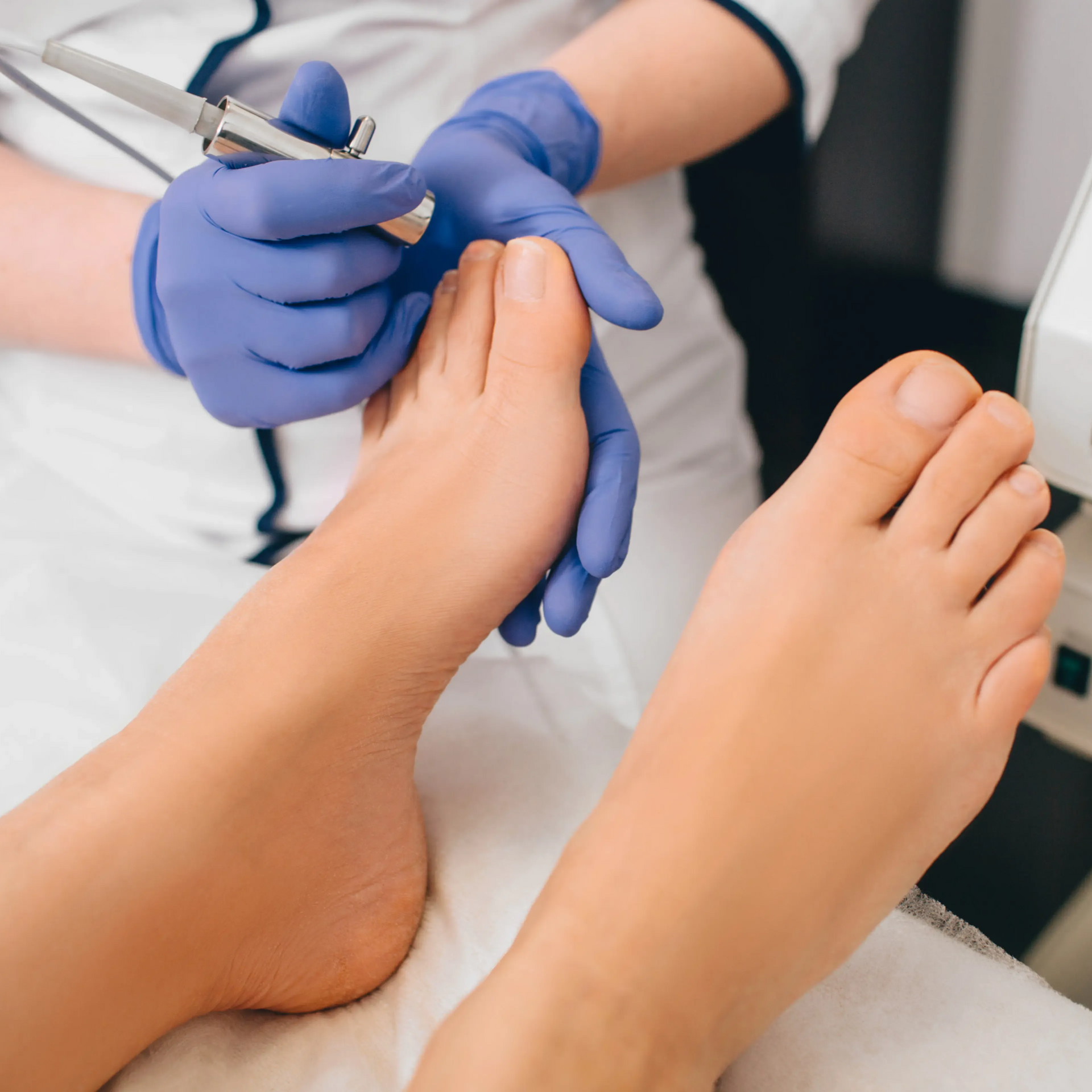Podiatrist clipping toenails with blue gloves during a foot care treatment