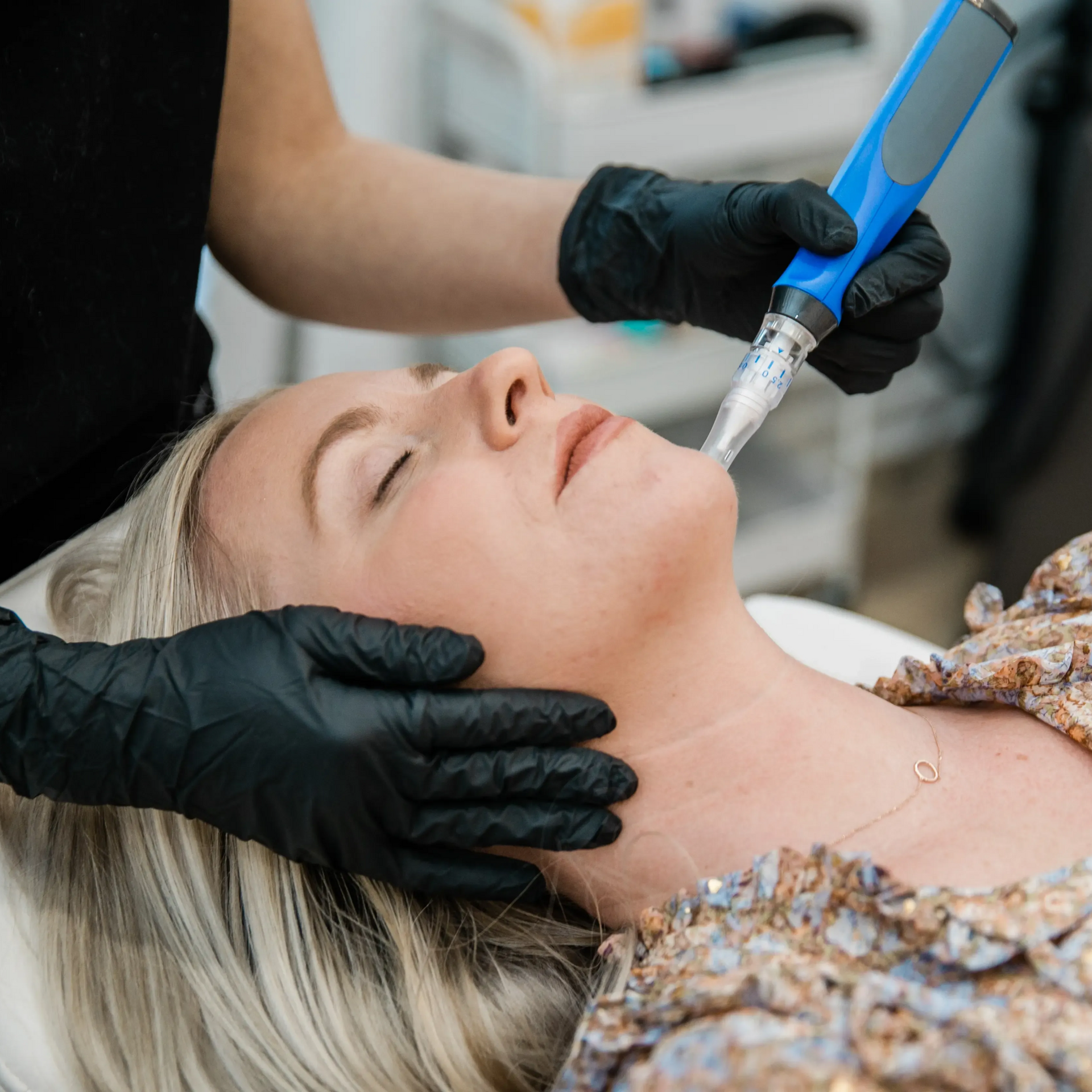 Gloved clinician using a blue facial treatment device on a reclining patient in a spa clinic