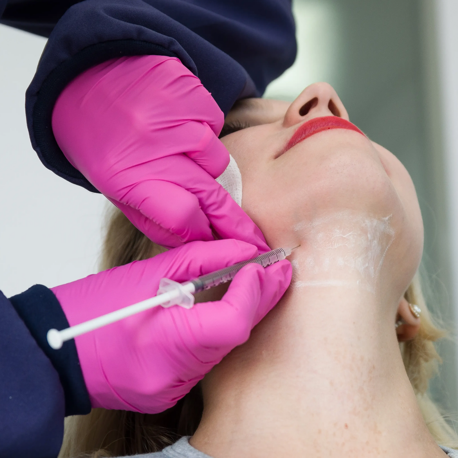 Gloved hands inject filler into a patient's chin and jawline in a cosmetic procedure