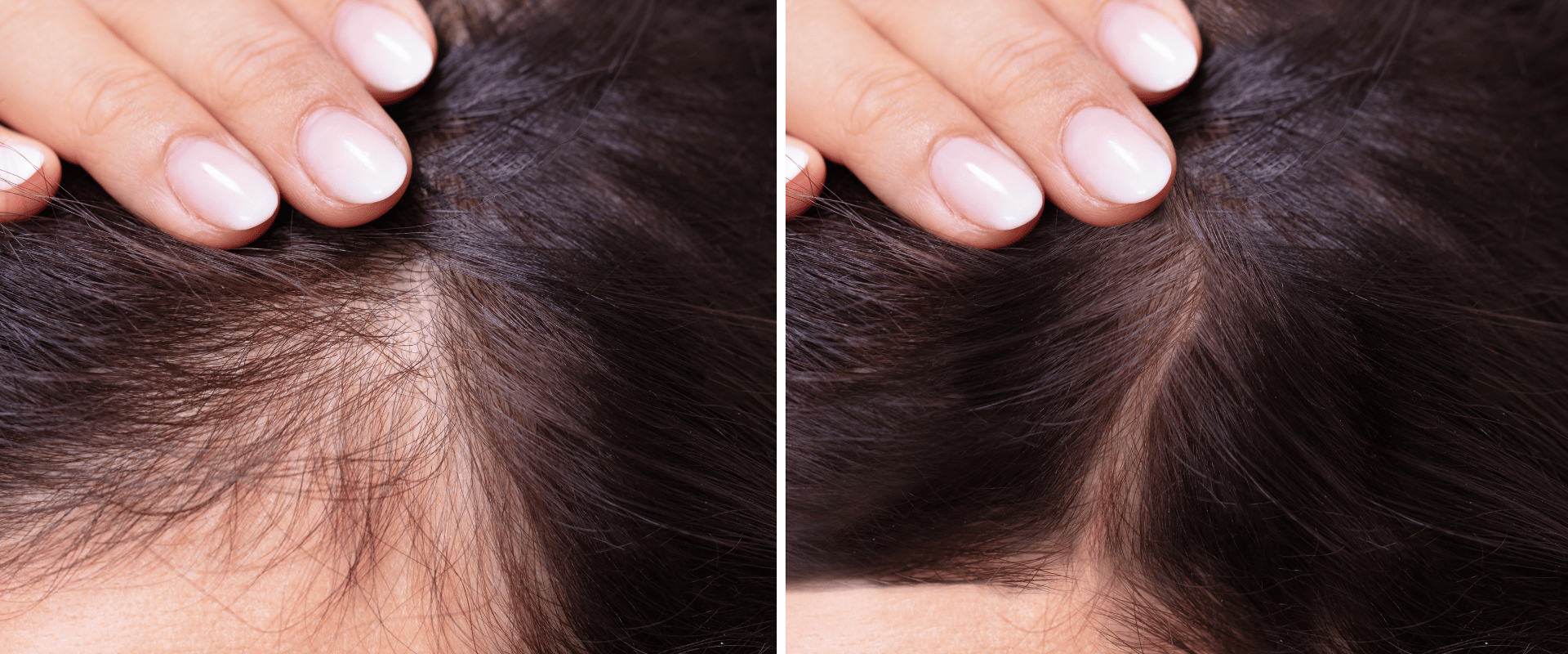 Close-up of a scalp with visible thinning hair parting before and after