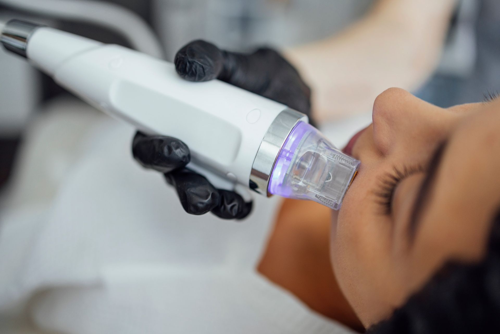 Gloved clinician using a handheld facial treatment device on a patient’s cheek