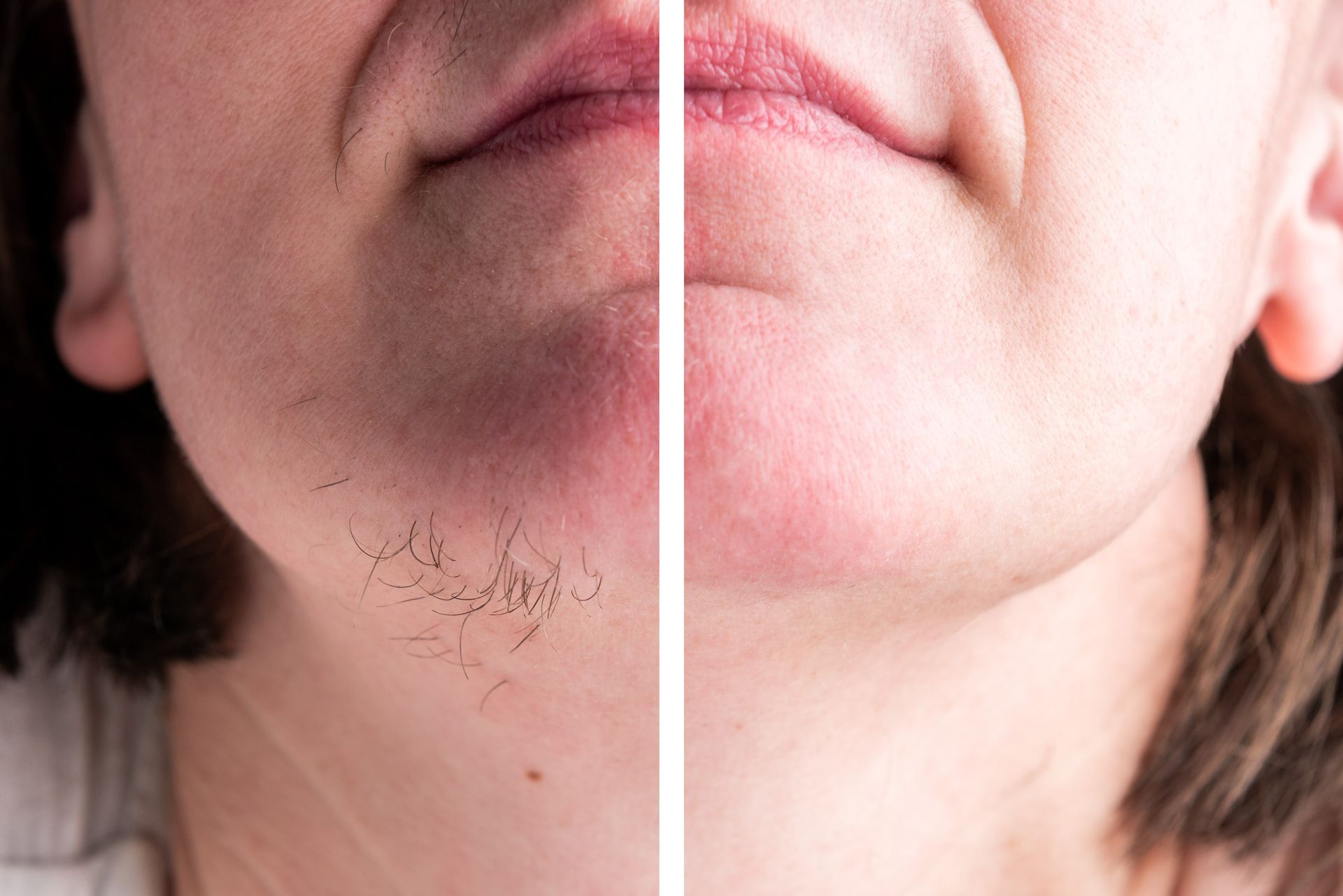 Split close-up of a person’s chin with sparse hair on one side and smooth skin on the other