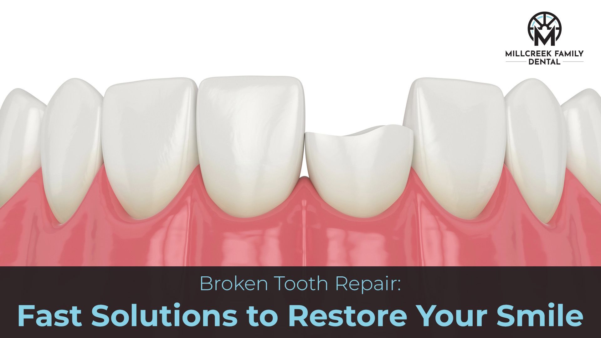 Broke a tooth in Bountiful, UT? Get repair for chipped or broken teeth at Millcreek Family Dental. Restore your smile and