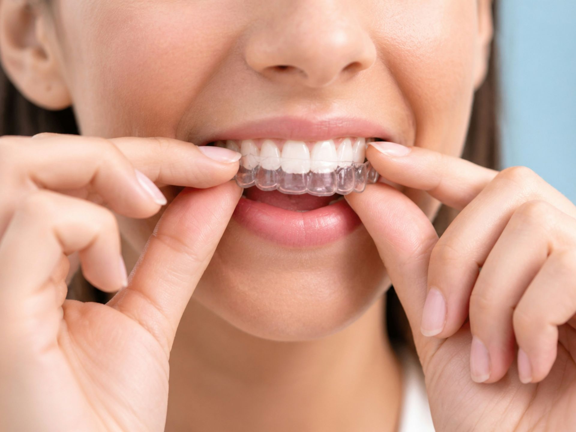 Person smiling while fitting a clear orthodontic aligner on their teeth