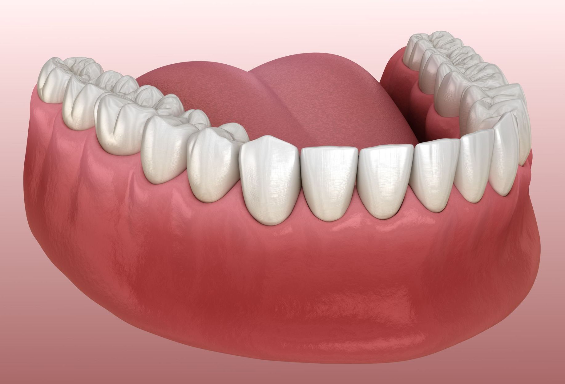 Lower human teeth and gums; tongue visible, pink background.
