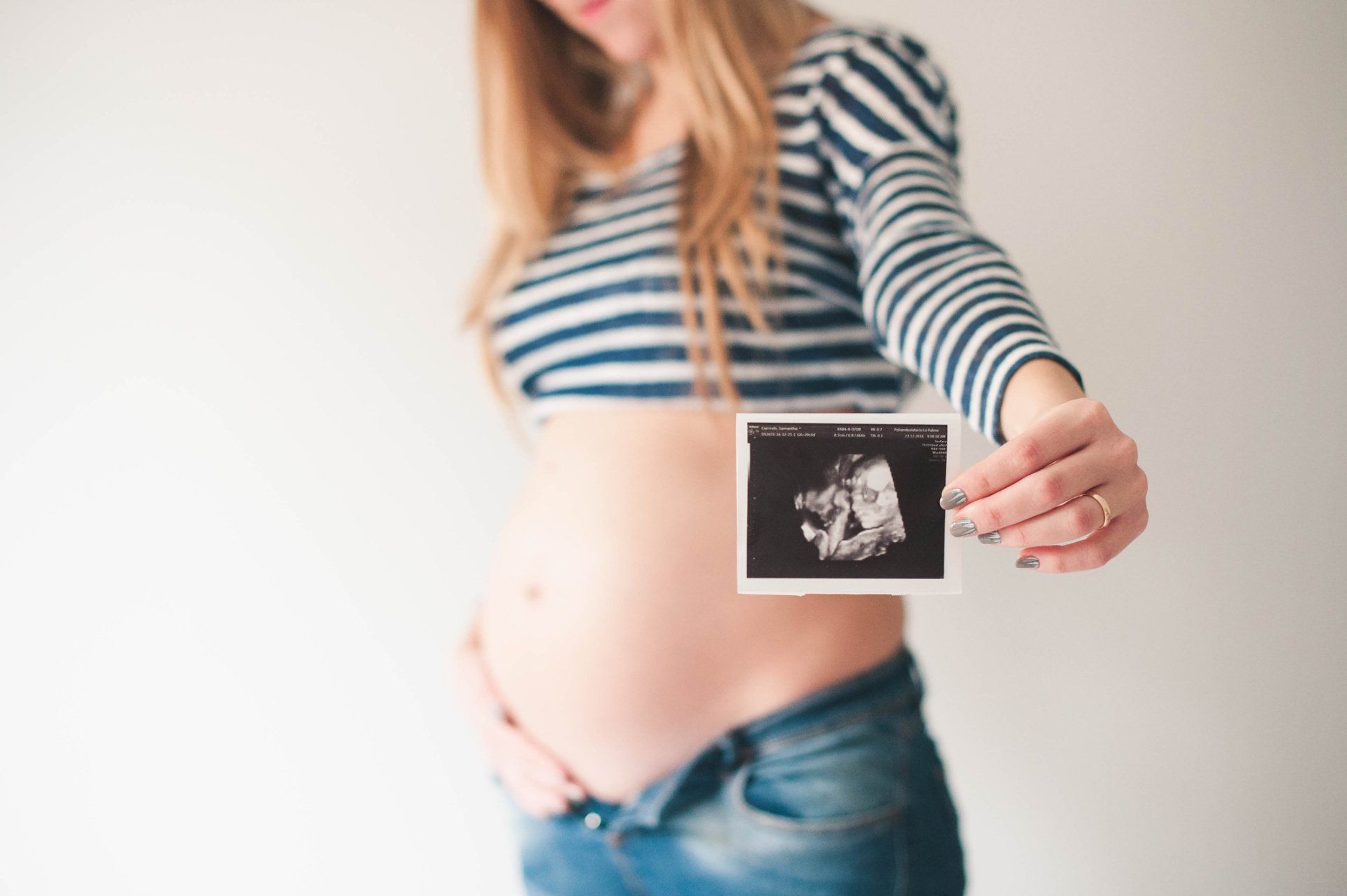 Pregnant caucasian woman wearing a striped shirt and blue jeans — New Hartford, NY — Oxford Medical Imaging