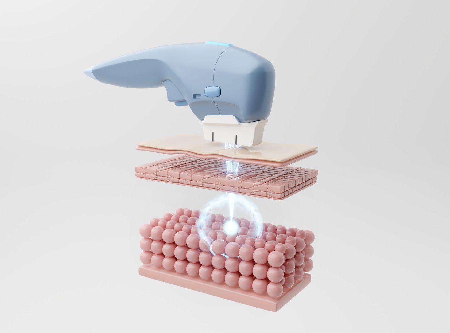 Eine 3D-Darstellung einer Maschine, die ein Stück Haut durchschneidet.
