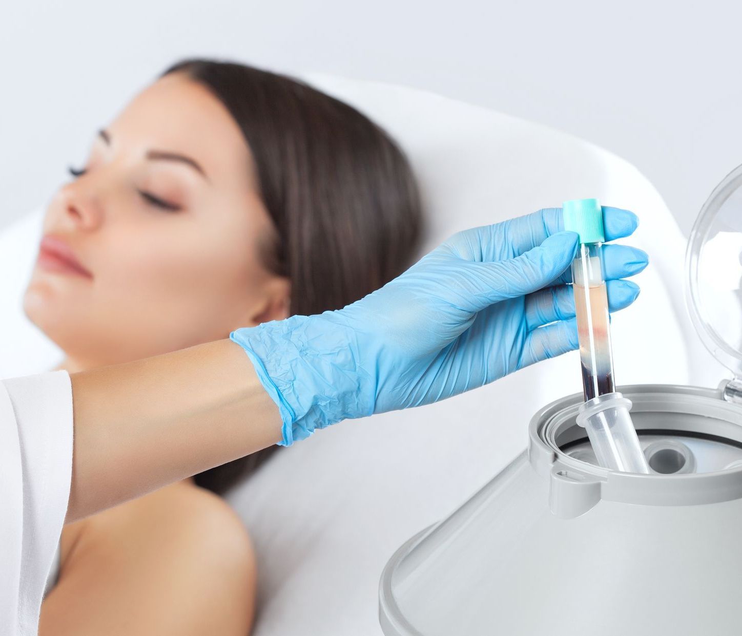 PRP Vampirlifting
