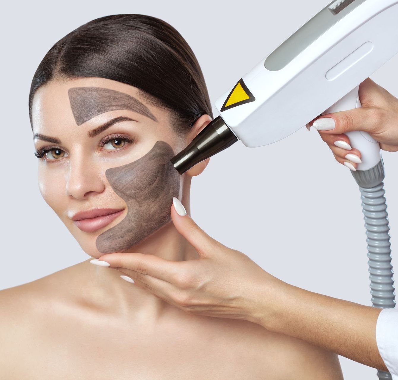 Eine Frau bekommt eine Laserbehandlung im Gesicht
