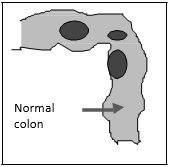 Normal Colon