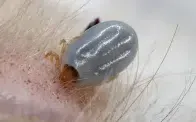 Engorged tick embedded in white fur, with visible mouthparts.