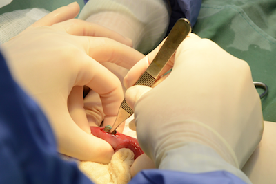 SURGEY.png Hands in gloves performing surgery with surgical instruments on tissue.