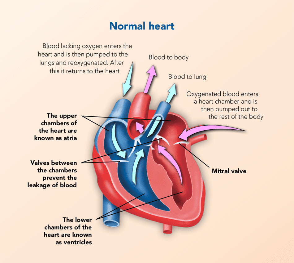 Heart disease in dogs