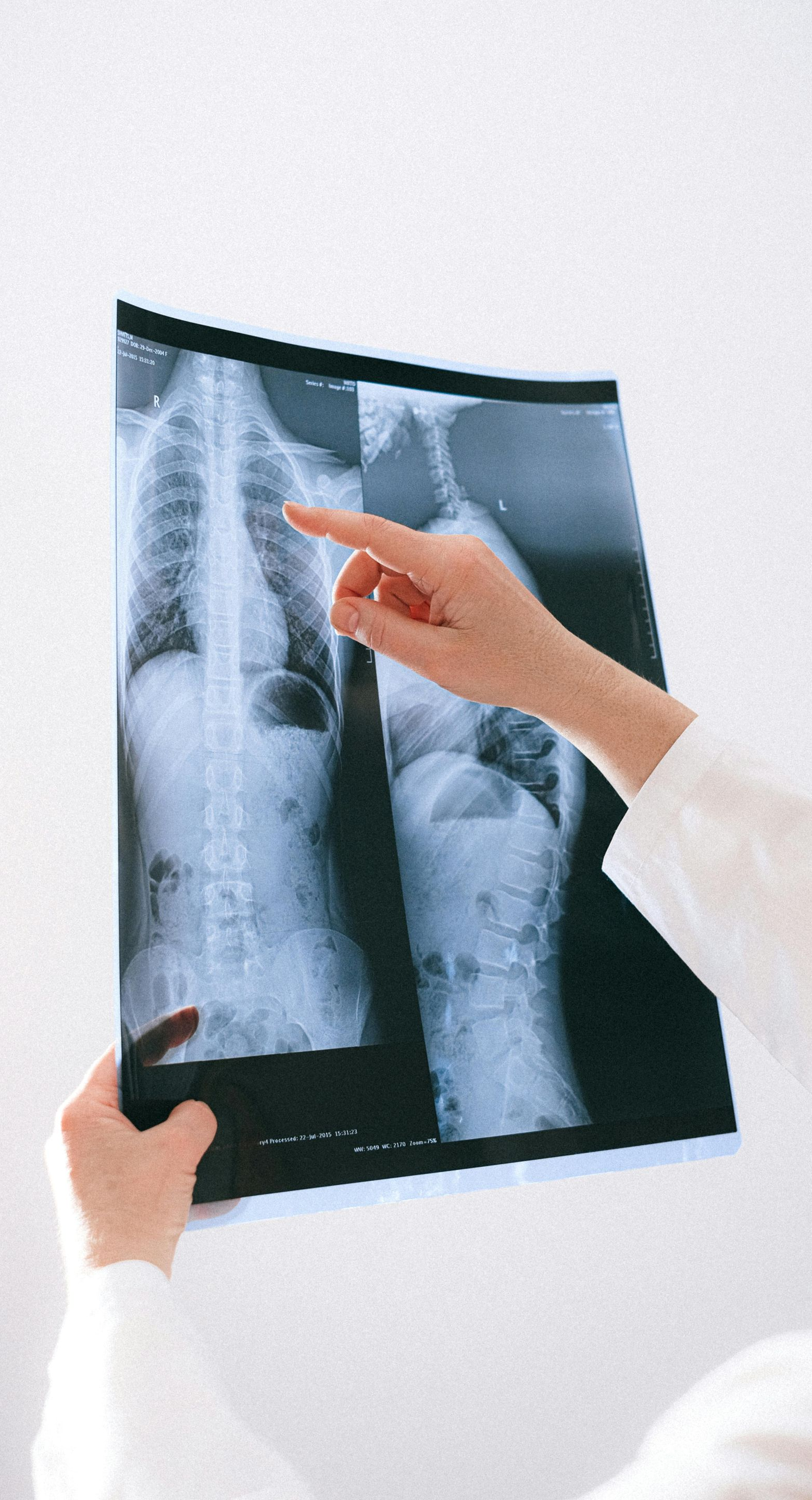Doctor points to lung area on chest X-ray.