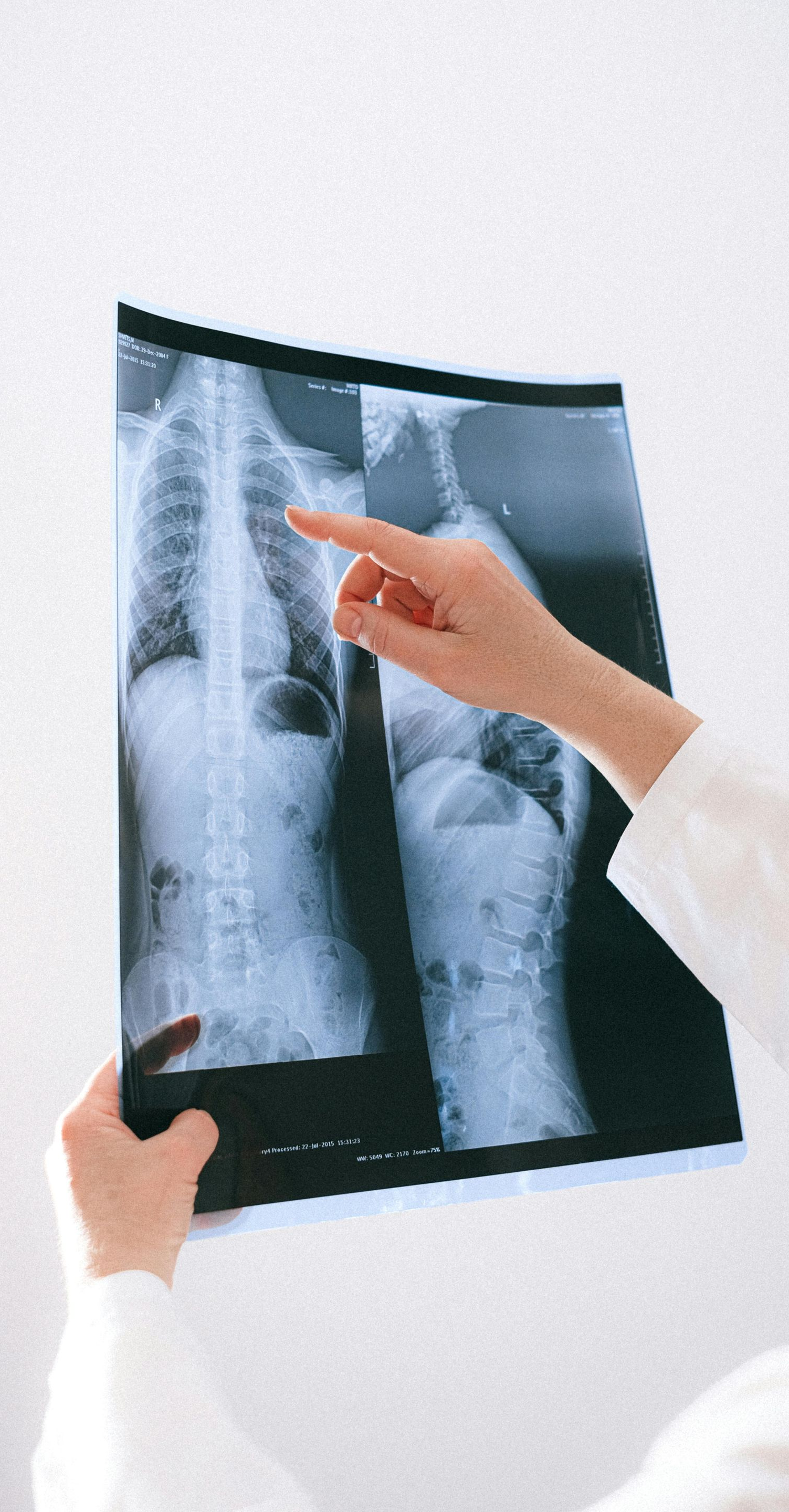 Doctor points to lung area on chest X-ray.