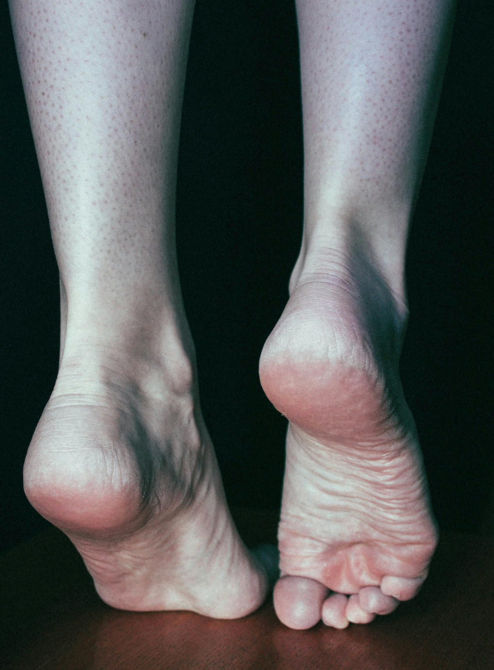 Bare feet, raised on the toes, heels lifted; dark background.