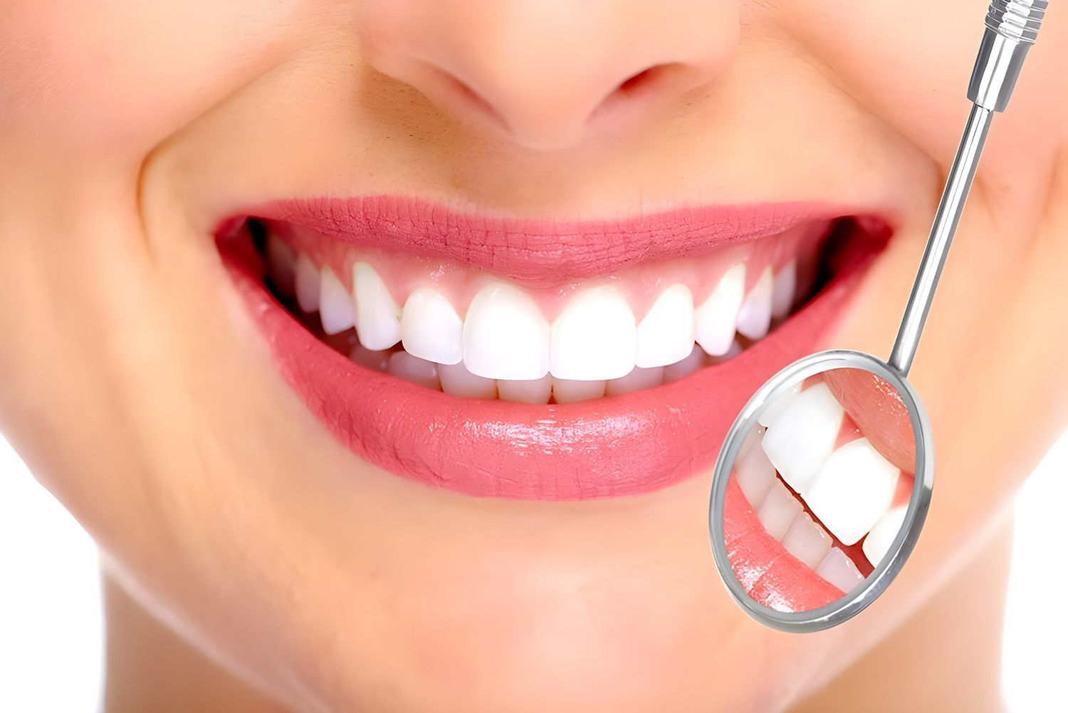 A Close-Up Of A Person With A Bright, White Smile, With A Dentist's Mirror Reflecting Their Teeth