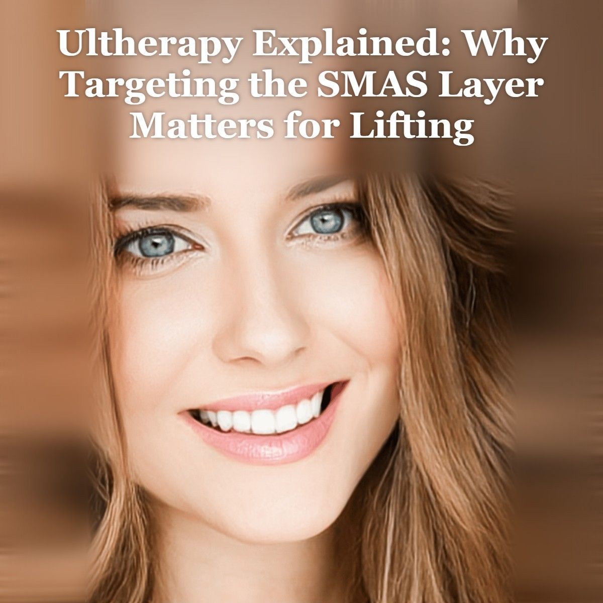 Ultherapy SMAS lifting guide