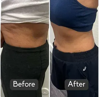 A before-and-after comparison showing a person's midsection, highlighting a reduction in waistline size.