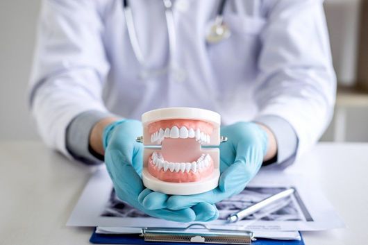 modellino di dentatura