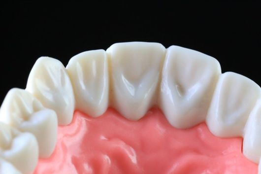 gengive e denti