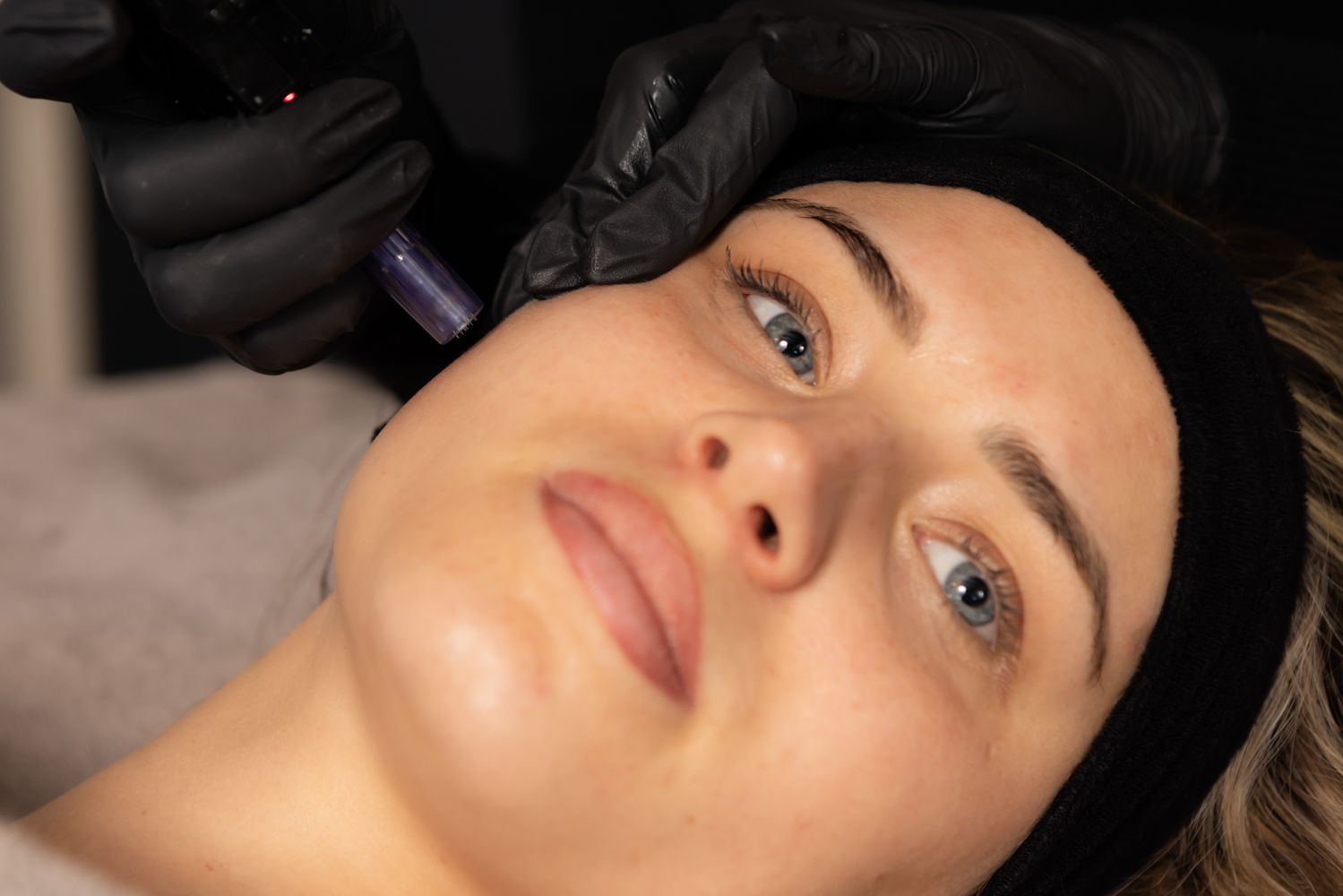 huidverbetering apparance glow gezichtsbehandeling dermapen peelings microneedling collageen hyaluronzuur etten-leur huidspecialist 