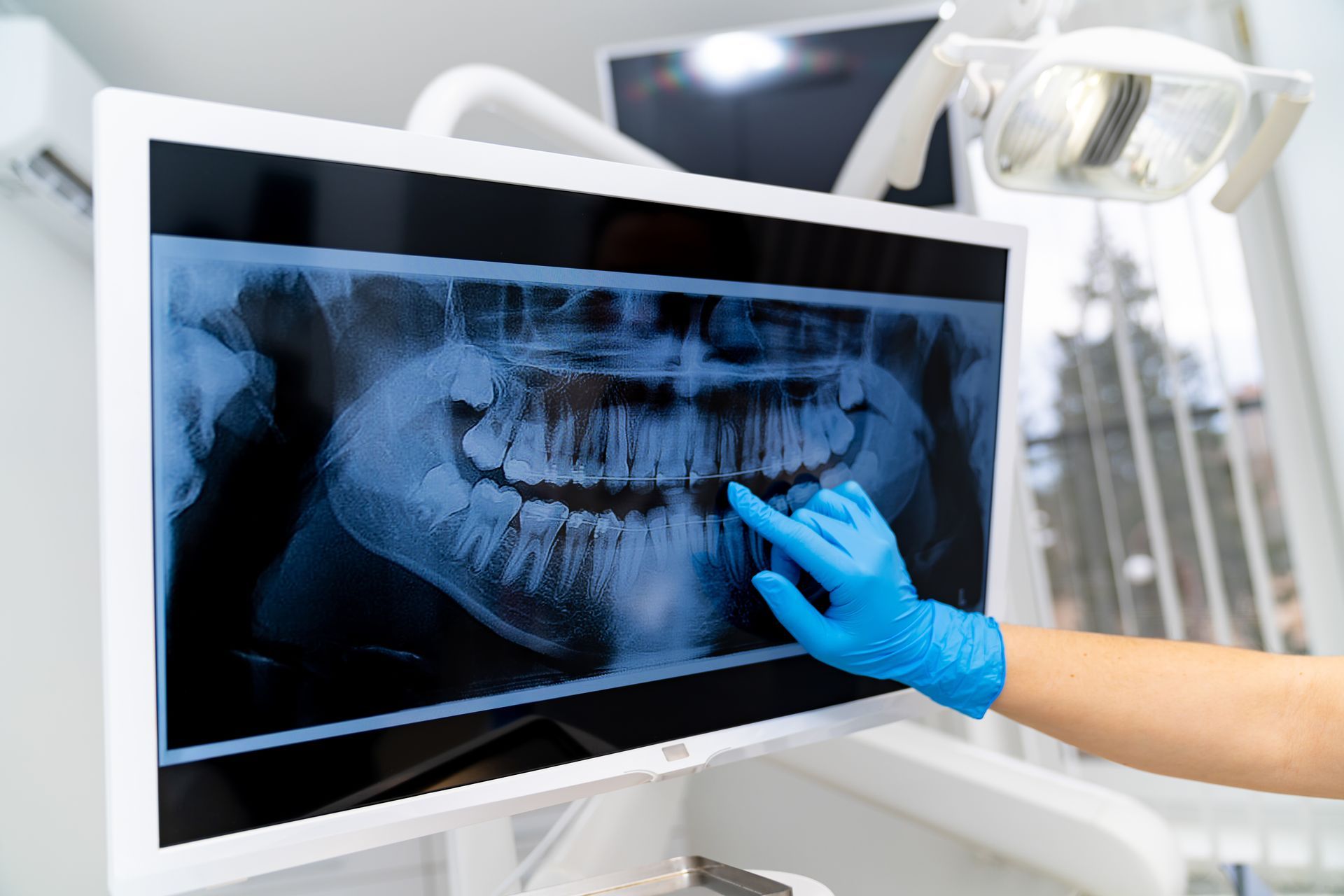 Dentist pointing at a panoramic dental X-ray on a monitor in a clinic