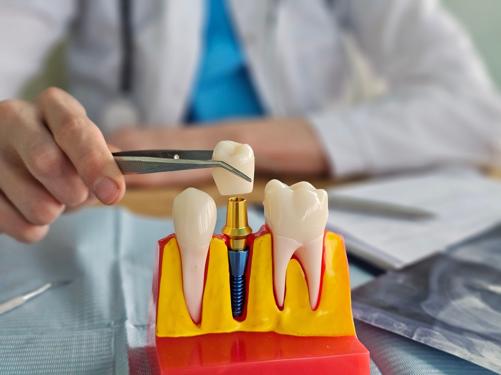 Dentist using a tool on a dental implant model with teeth and gums